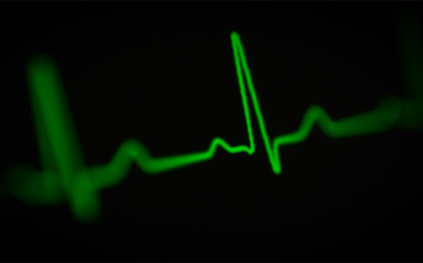 Heartbeat Line
